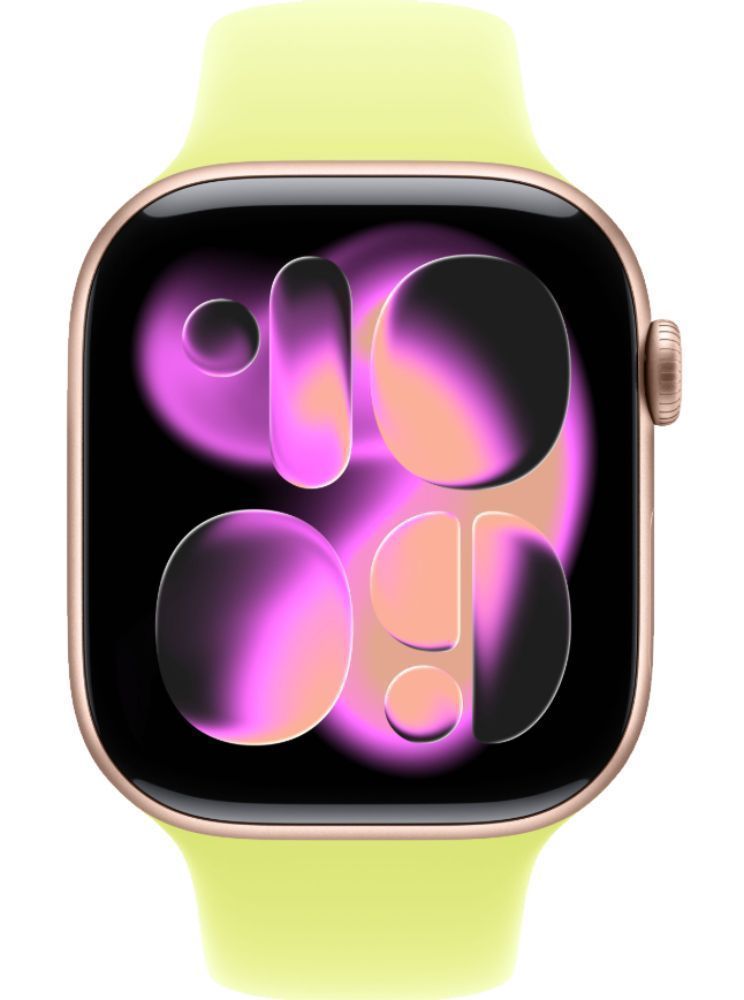 Apple Watch Series 11 - Image 34